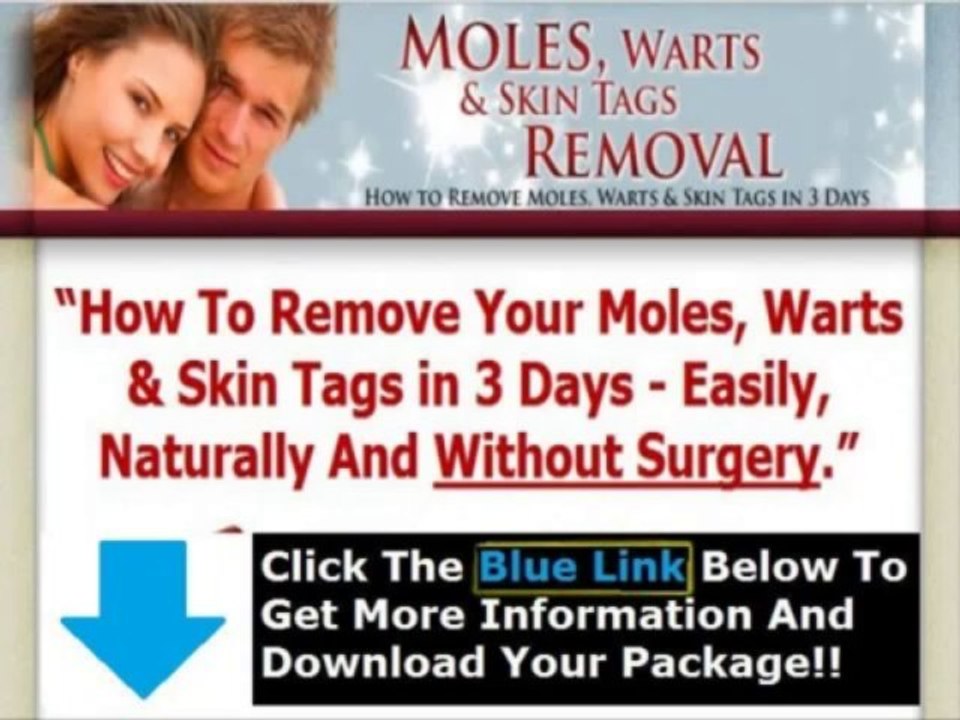 Moles Warts & Skin Tags Removal Pdf + Moles Warts Removal Review