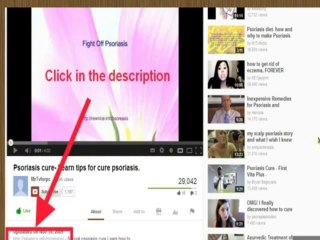 Watch Now --- uterine polyps treatment