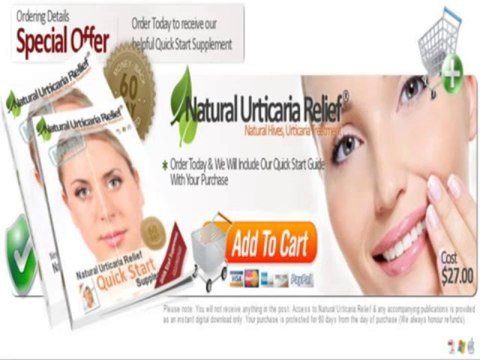 Natural Urticaria Relief Review + Discount +++ 100% Real and Honest +++