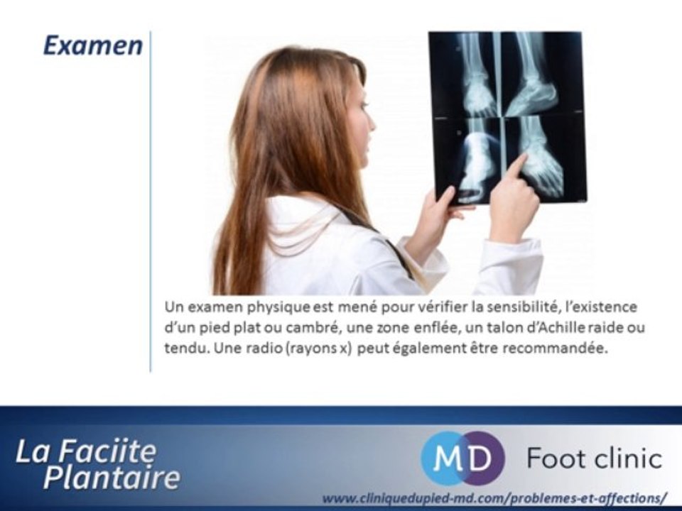 Fasciite plantaire : Origine, Cause , Examen , Traitement de la Fasciite Plantaire