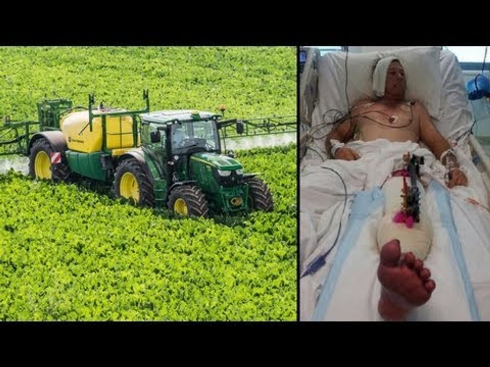 Man vs tractor: Leg 'bursts' after tractor pins farmer to ground
