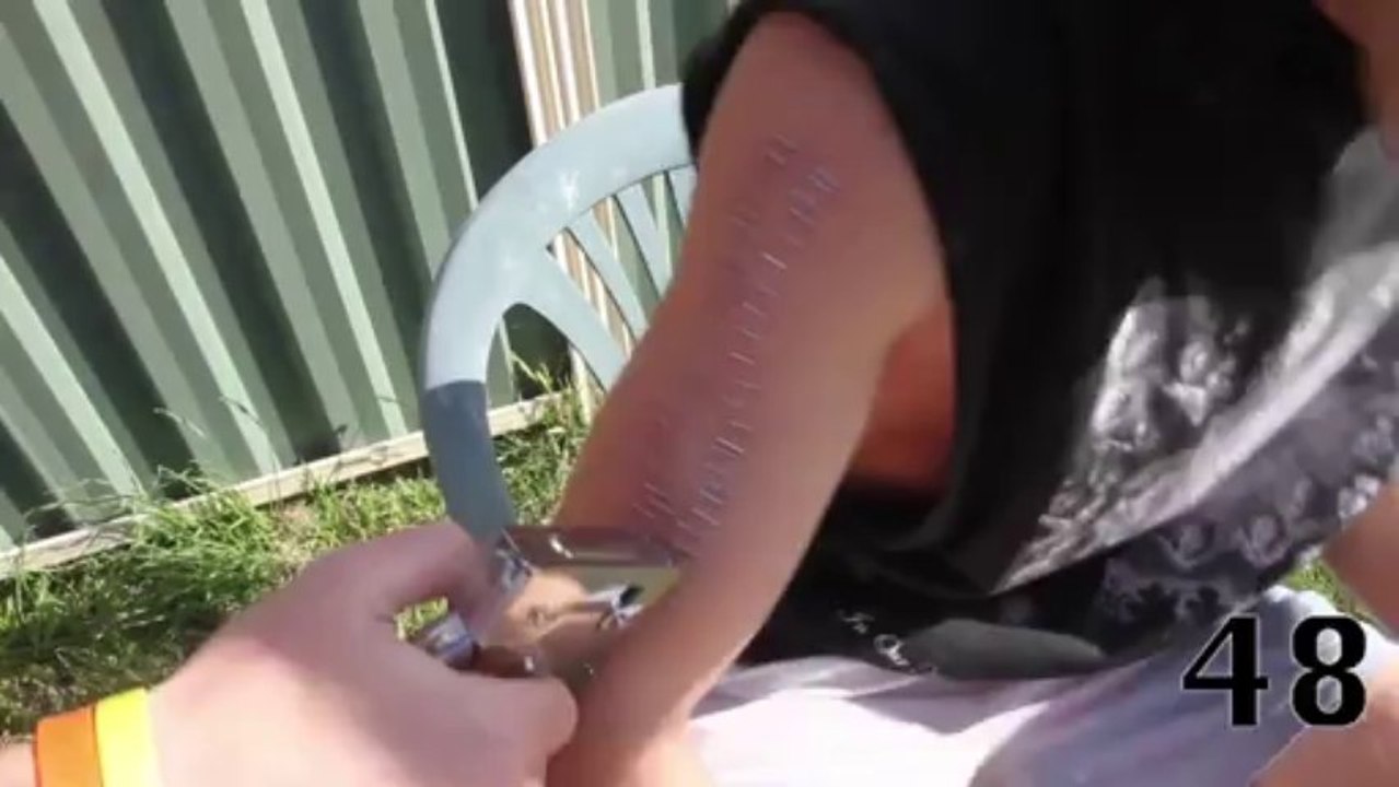 He gets stapled 100 times on his arms and head!! Crazy Challenge!!