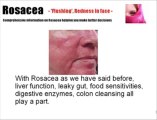 Acne Rosacea or Redness on face- Is our body telling us to stop something