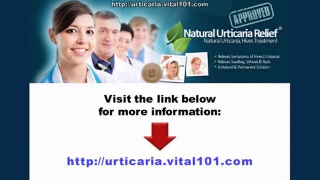 How To Get Rid Of Hives Naturally - Natural Cure For Hives - Urticaria And Angioedema Treatment