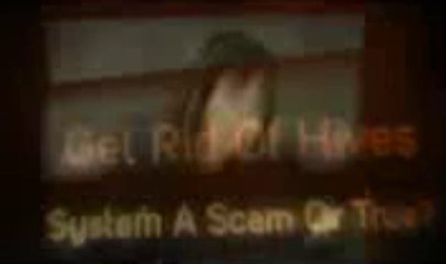 Get Rid Of Hives Review And Exclusive Bonus | Is It Scam Or