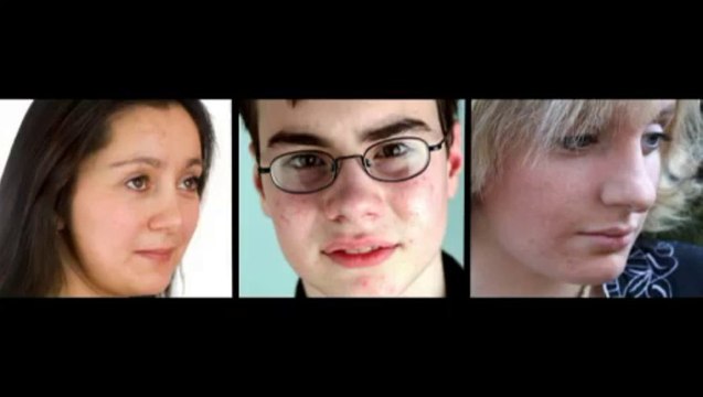 Watch Acne Rosacea, Then Mac, Drugstore Haul - Rosacea Acne