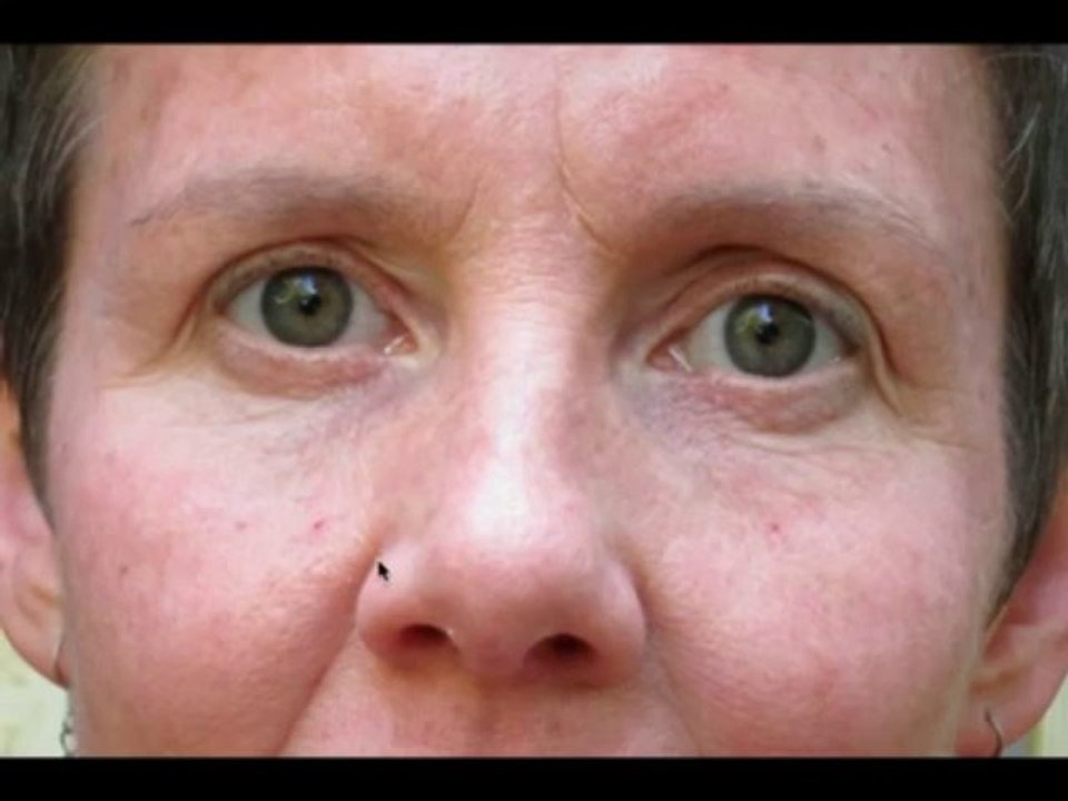 The Acne Practice  (Rosacea Bootcamp™)