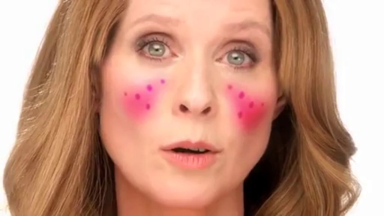 Cynthia Nixon's Rosacea Story