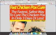 How To Buy Fast Chicken Pox Cure by Stefan Hall