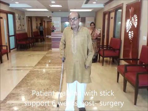 Best Knee Replacement Surgery In India - Gurgaon/ Delhi NCR