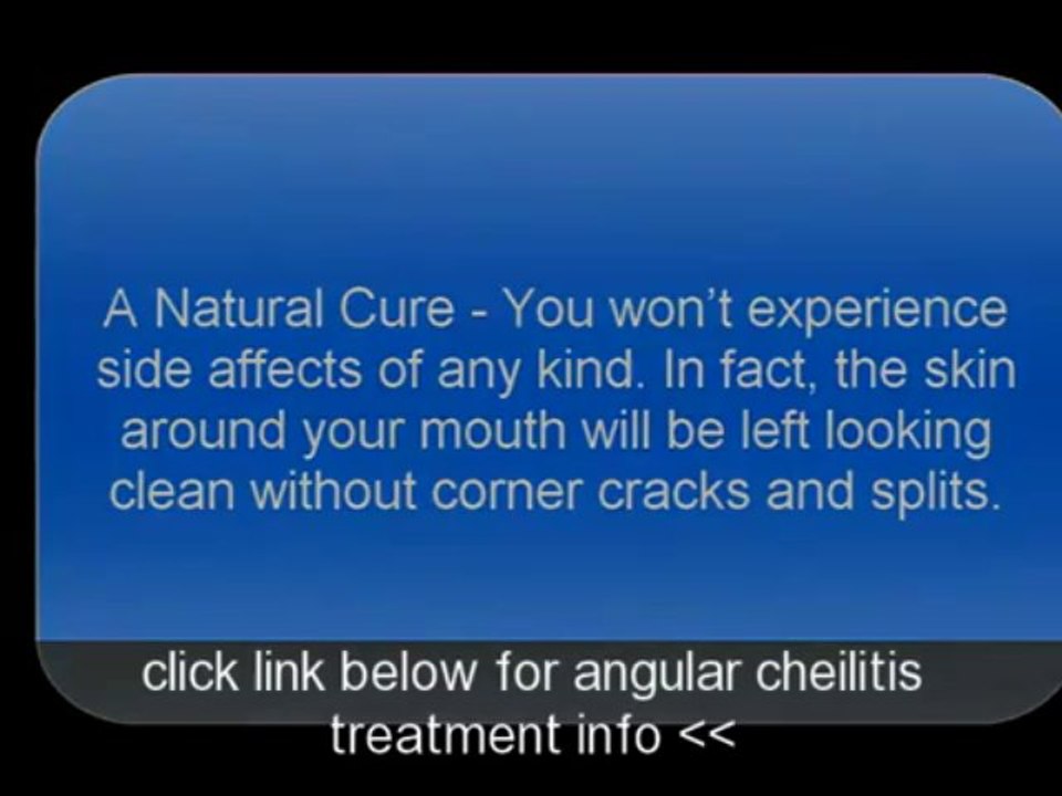 best angular cheilitis overnight cure