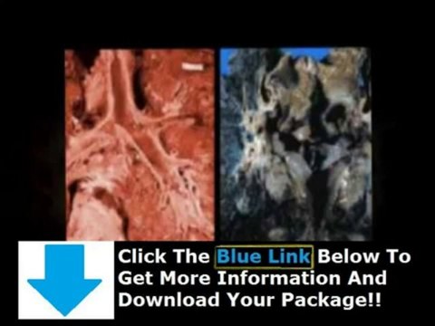 Lung Detoxification + Lung Detox After Quitting Smoking