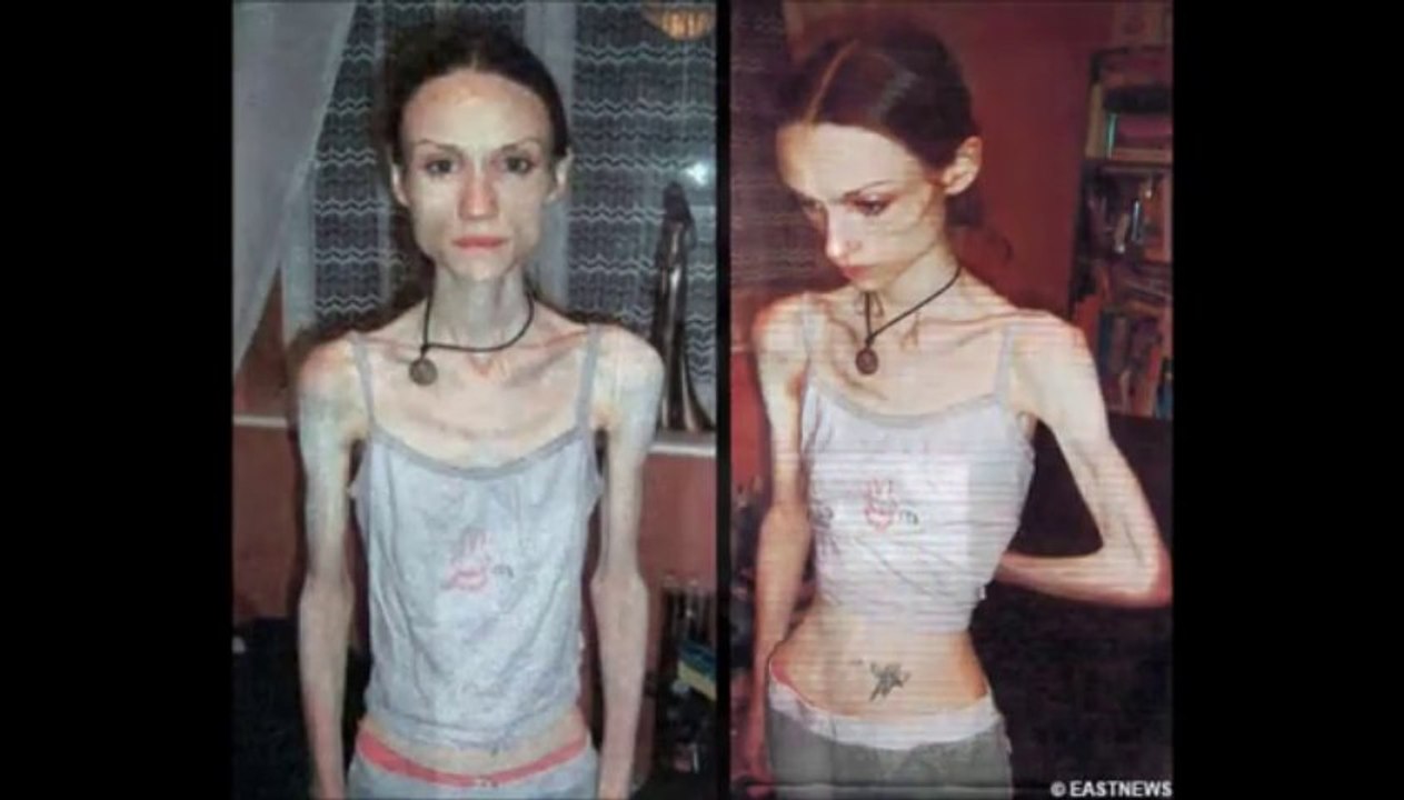 Barbie- A Thinspiration