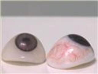 افتتاح مركز لصناعة وتركيب العيون بغزة