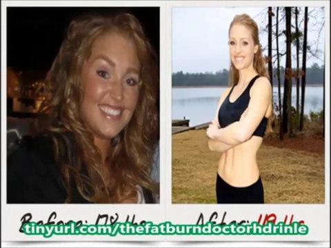 The Fat Burn Doctor Lose Belly Fat | Fat Burn Doctor Free Download