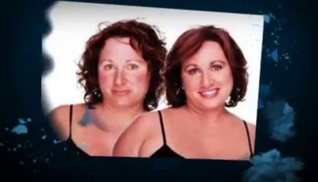 Treatment Rosacea - Acne Rosacea