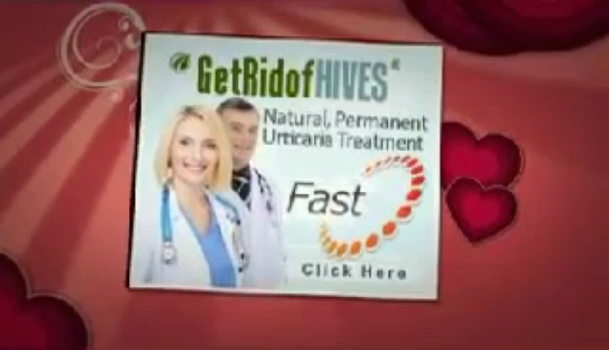 Get Rid Of Hives Forever eBook Download