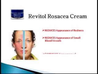 Rosacea Treatment  Review