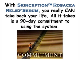 Don&#39;t Get Skinception™ Rosacea Relief Serum Until You Watch This Review!