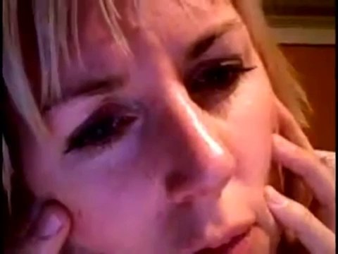 Acne Rosacea Treatment (How to Reduce Rosacea) Rosacea Treatment Tips