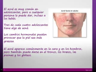 Aloe vera, rosacea y acne en vivo
