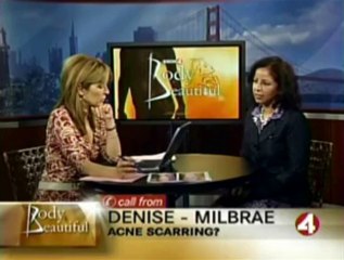 Laser Rosacea Treatment San Francisco Bay Area