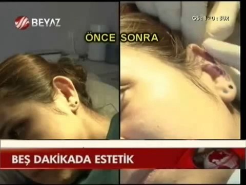 Op Dr Mustafa Ali YANIK Ameliyatsız Burun Estetiği ve Kulak Estetiği