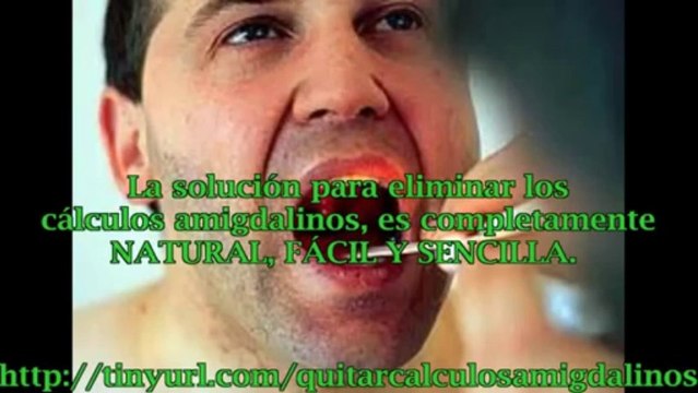 Remedios naturales para calculos amigdalinos