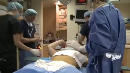 Tummy Tuck Surgery - New York - Dr. Douglas Steinbrech