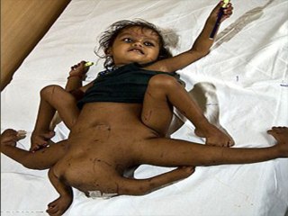 WTF Girl With 8 Limbs