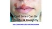 Best Cold Sore Treatment - How To Get Rid Of Cold Sores Fast