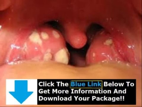 Los Calculos Amigdalinos + Los Calculos Amigdalinos