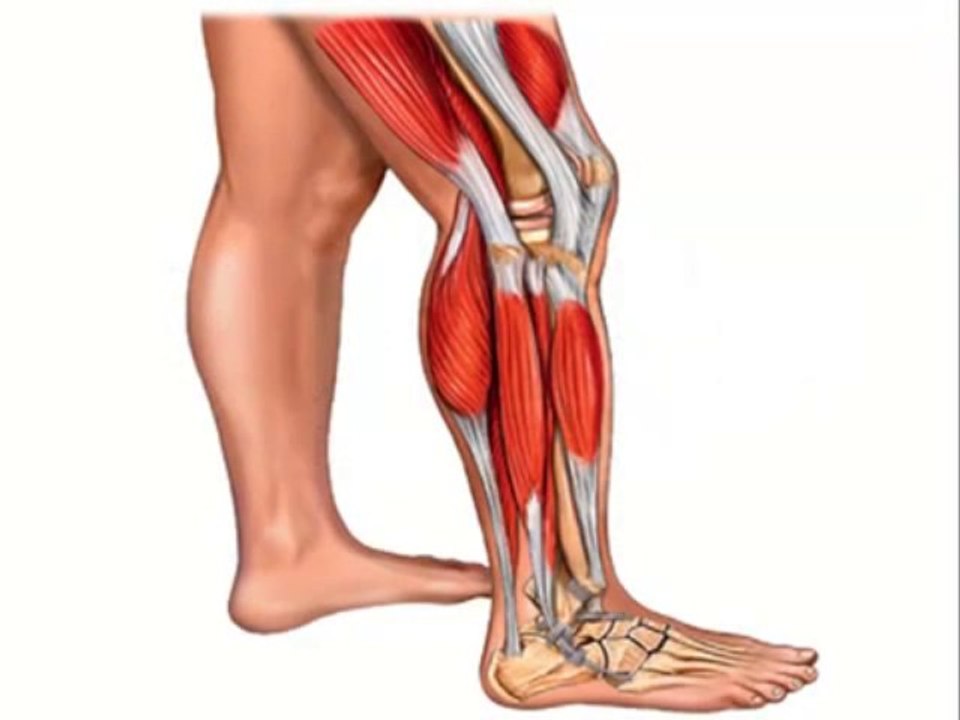 Foot Pain Natural Home Remedies: How To Stop Shin Splints Forever