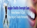 Angular Cheilitis Overnight Cure Review & Discount