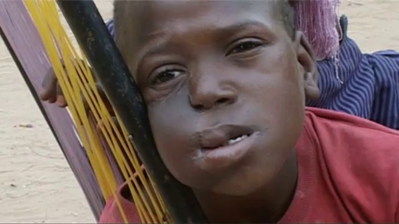 Harouna Aboubacar Zeinabou Enfants du Noma - Extrait 1