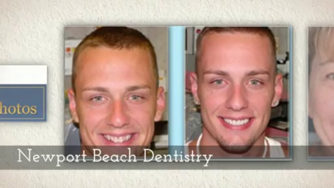 cosmetic Dentistry Orange County - (888) 684-4436 Call Now! Grant A. Burdick, D.D.S. Designed Smiles