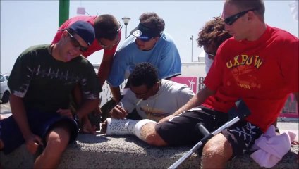 frattura metatarso del piede