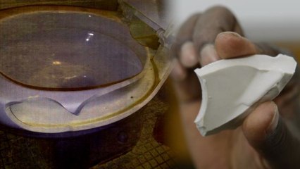 Exploding Toilet Hospitalizes Brooklyn Man