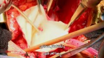 HD بي بي سي هورايزون العودة من الموت