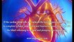 Heart Disease Treatment By Stem Cells, Does Heart Disease Treatment By Stem Cells Work