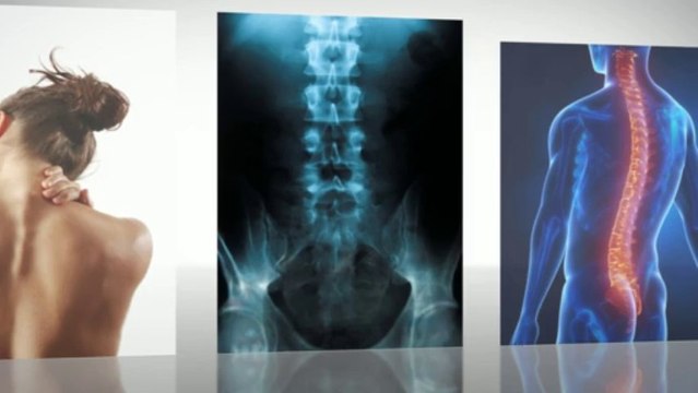 Artificial Disc Replacement Spine Surgery Abroad