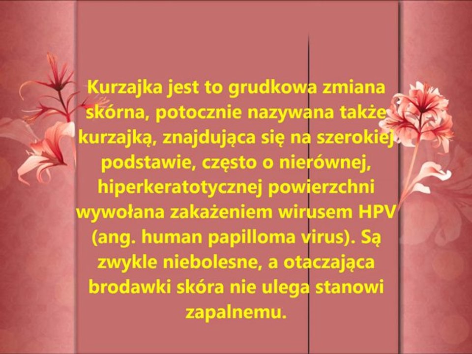 Jak pozbyć sie kurzajek / brodawek Domowy sposób !