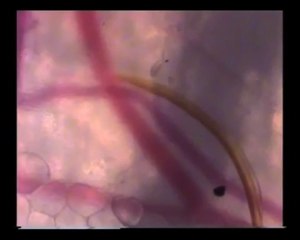 Vue au microscope d'un moustique qui cherche du sang