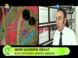 Op. Dr. Deniz KÜÇÜKKAYA - Meme Kanseri (Show TV)