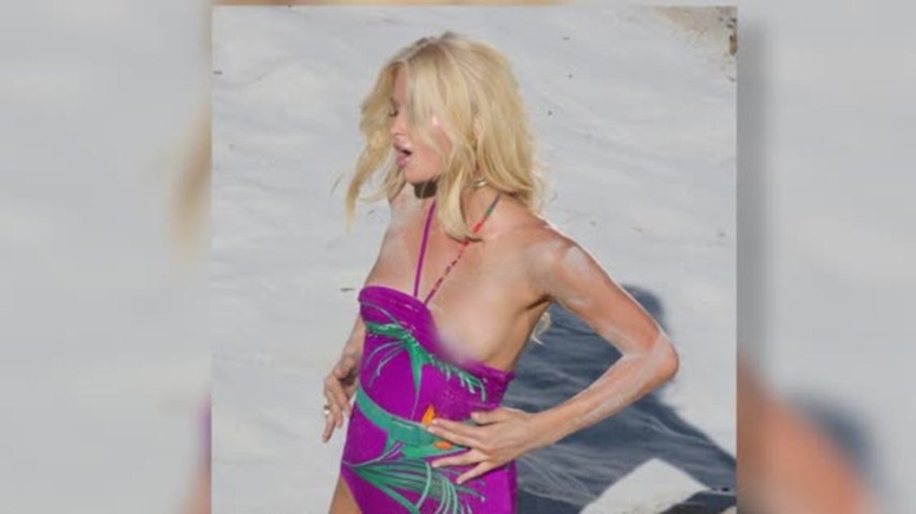 Die 10 schlimmsten Bikini-Unfälle