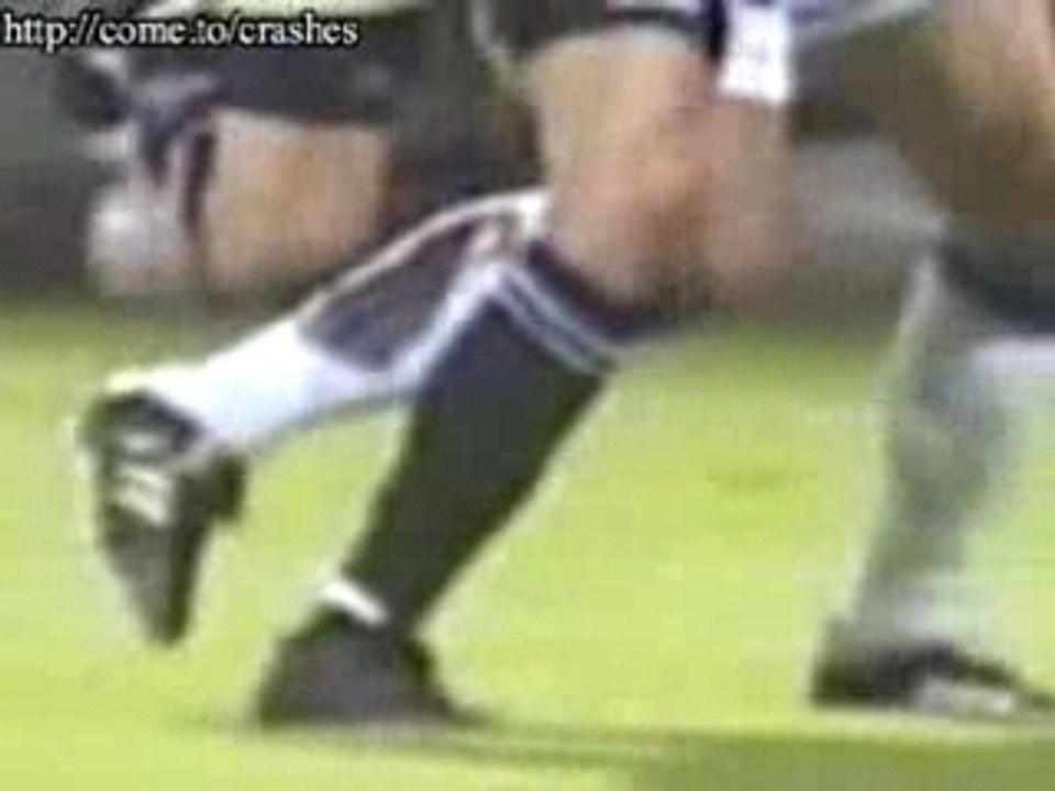 Soccer Broken Leg Accident Vidéo Dailymotion