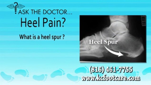 Do I Have A Heel Spur? Overland Park, KS and Kansas City, MO - KC Foot Care