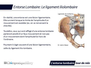 L'entorse lombaire - tour de rein