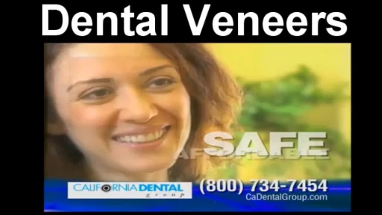 Dental Veneers North Hollywood-Dental Veneers Van Nuys