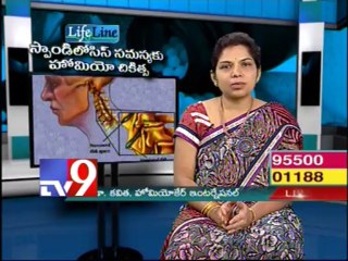 Homeo treatment for Spondylosis problems - Life Line